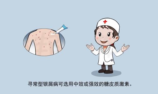 银屑病如何治疗