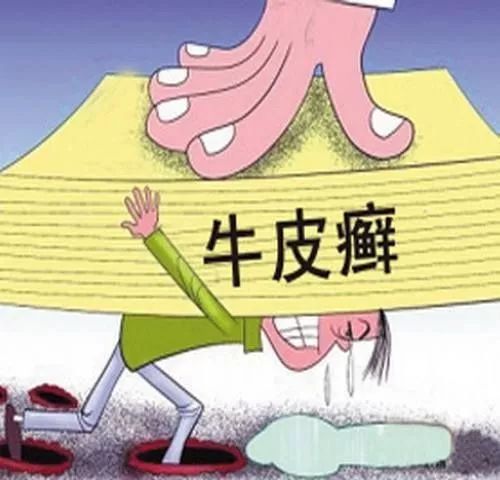 银屑病的危害