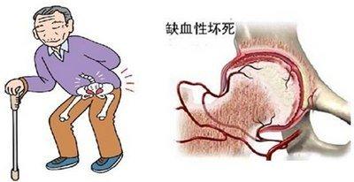 广州哪家治疗牛皮癣医院康复效果好