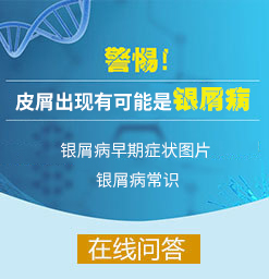 广州牛皮癣治疗医院怎么选