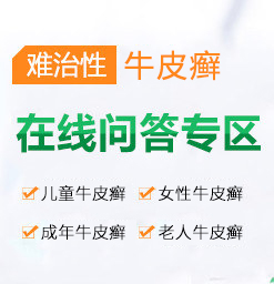 银屑病治疗到正规医院收费合理