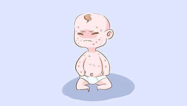 儿童银屑病常见病因